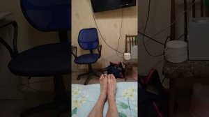 Антропометрия, спустя два месяца после перелома.