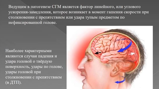Сотрясение головного мозга смотреть онлайн