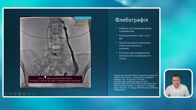 Власний досвід лікування хворих з тазовими венозними порушеннями. Андрій Олександрович Никоненко смотреть онлайн