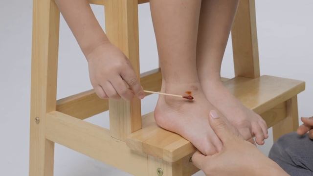 Как избавиться от бородавок и папиллом? Эффективный домашний рецепт от известного доктора Берга смотреть онлайн