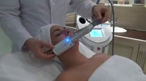 эндосфера лица