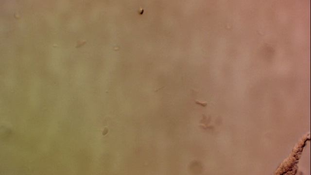 My Lyme Diseased blood on BSK-H 5 days смотреть онлайн