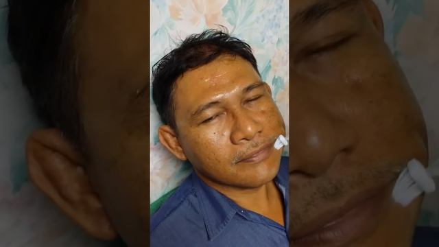 Face peeling by Enerpeel of Italy 28 Aug 2014 смотреть онлайн