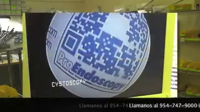 Fibroscopio Flexible смотреть онлайн