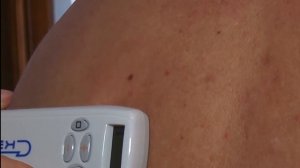 Работа с аппаратом ЧЭНС 01 СКЭНАР М в индивидуально дозированном режиме