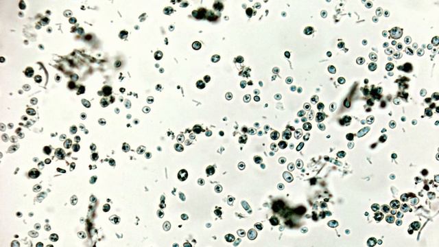Винные дрожжи в разных стадиях жизненного цикла смотреть онлайн