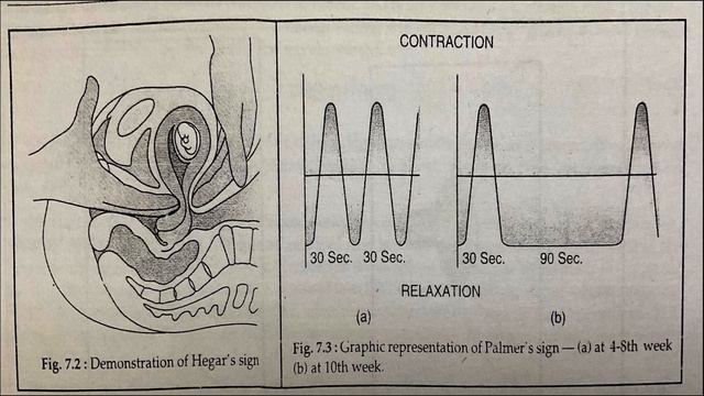 Model question paper II post basic bsc nursing entrance exam II for all nursing exams  interview I