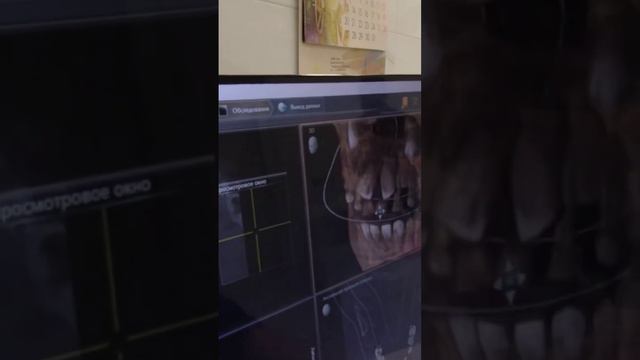 Удаление молочных зубов у ребёнка. Череп, кровь и кости. Полное видео https://youtu.be/mt0_ZEVZ5DU смотреть онлайн