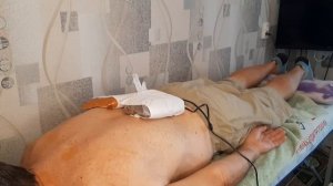 Лечение " замороженного плеча". Витафон. Подробно.