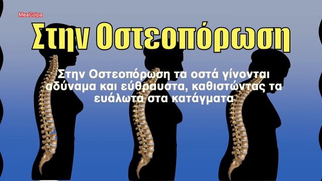 Τσουκνίδα Το Βότανο Που Θεραπεύει Τα Πάντα смотреть онлайн