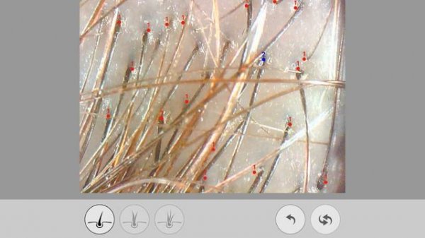 Возможности ASL, программа Solutionist, линза 202