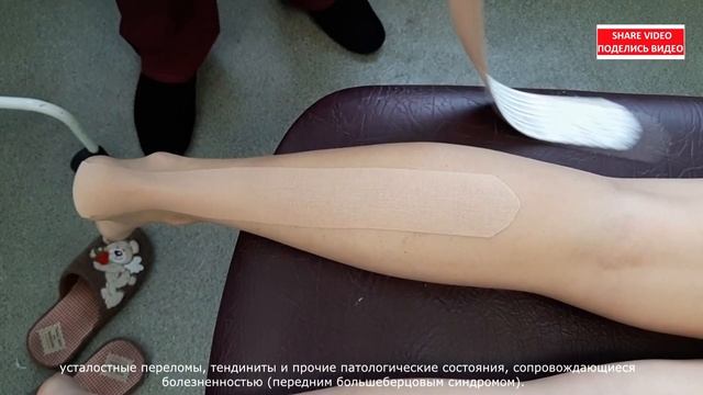 Тейпирование ахиллова сухожилия | Taping guide for Achilles Tendonitis смотреть онлайн