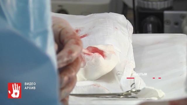 Второкласснику разорвало щеку в школьном туалете смотреть онлайн