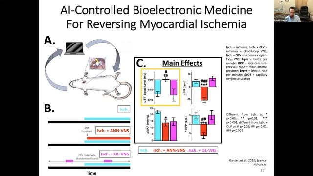 ASIA Early Career Webinar S01E04 - Neuromodulation смотреть онлайн