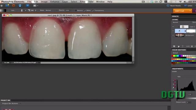 Learn Photoshop Elements - Remove Gaps in Teeth смотреть онлайн