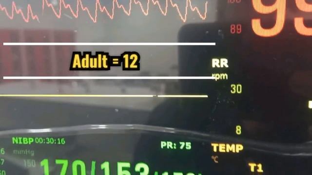 شرح جهاز Monitor مراقبة المريض смотреть онлайн
