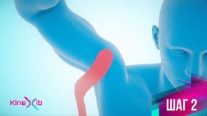 Kinexib - тейпирование широчайшей мышцы спины