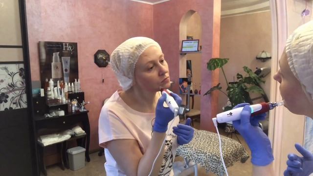 Мезотерапия/фракционная мезотерапия/дермапен/косметолог/омоложение