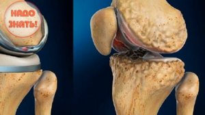 Почему хрустят колени?