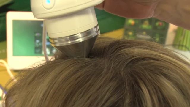 Диагностика кожи головы на аппарате капиллископ смотреть онлайн