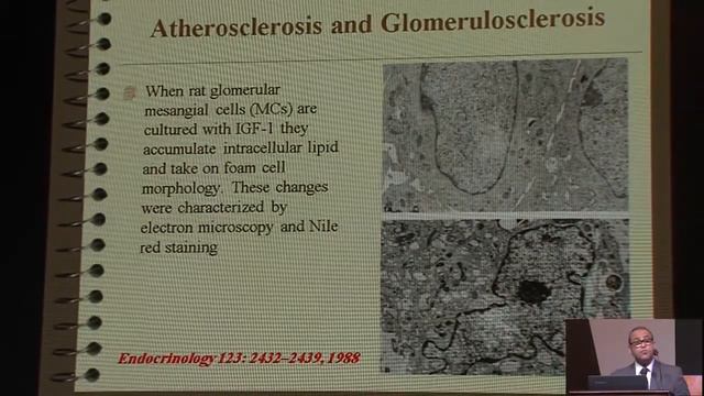 Obesity and kidney , Prof Hatem Darwich смотреть онлайн