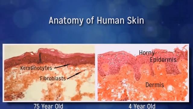 Замедлите процесс старения кожи с Трансфузиум !!! смотреть онлайн