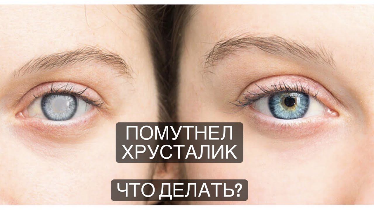 Профессор Дембский: восстановление зрения