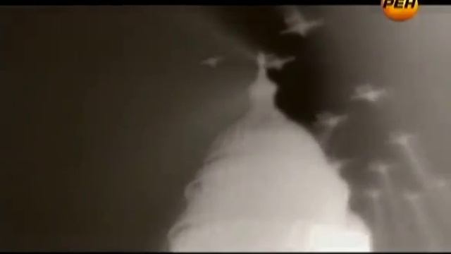 07 Космос Плохие соседи 18 11 2011 смотреть онлайн