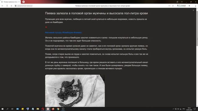 Пиявка залезла в мочеиспускательный канал мужчины и высосала пол литра крови смотреть онлайн