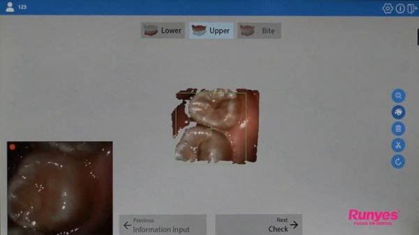 Scanner intraoral Runyes IOS