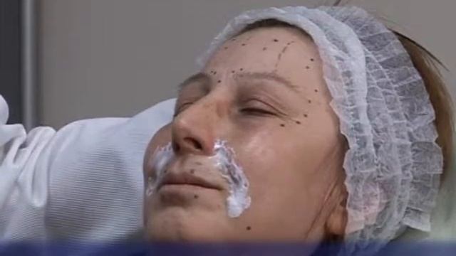 Ботокс смотреть онлайн