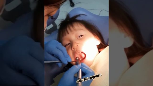 3 жасар пациентм 😍 Бізде дентофобия деген вообще жооқ ;) смотреть онлайн