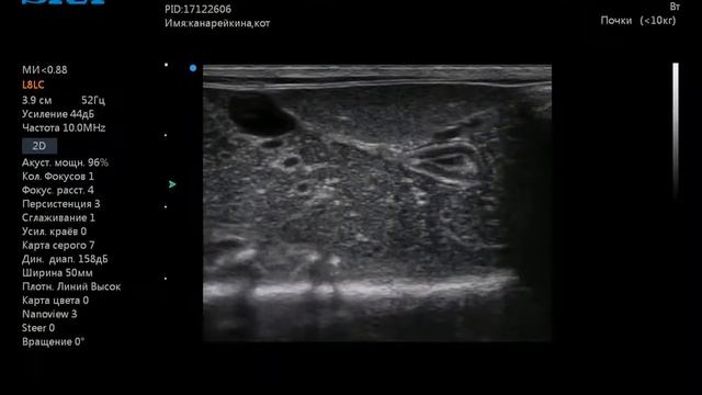 Дуоденальный сосочек двенадцатиперстной кишки у кошки смотреть онлайн