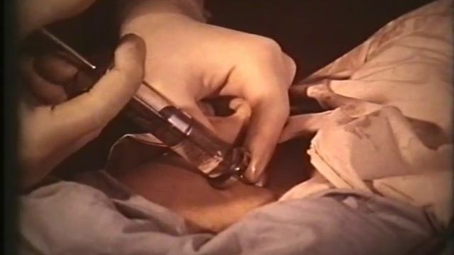 Ангиография © Angiography