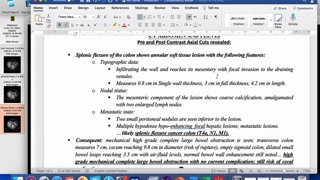 | GIT | IO | Cancer colon | reporting simulation | смотреть онлайн
