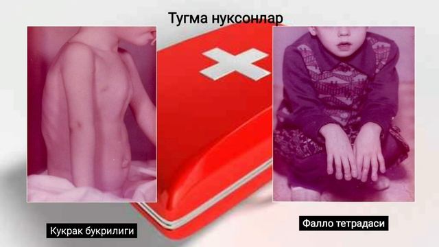 Врождённые пороки сердца. Туғма юрак нуқсонлари. смотреть онлайн