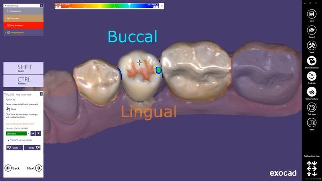 exocad Quick Guide Learn more about the main indication of single visit dentistry смотреть онлайн