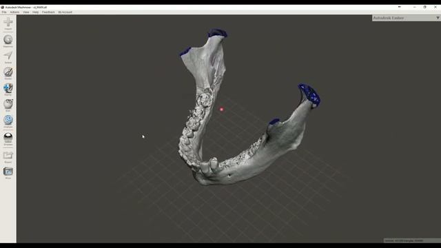 Convert Dicom CT to STL file 3D printable смотреть онлайн