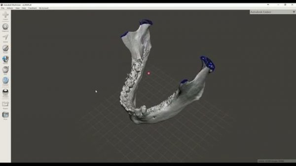 Convert Dicom CT to STL file  3D printable