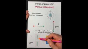 Как определить Электрическую Ось Сердца
