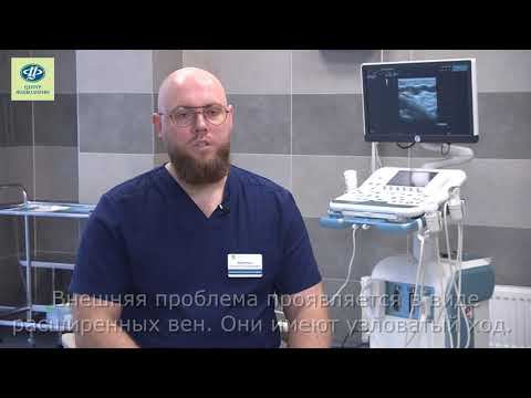 Основные симптомы варикоза. Когда обращаться к флебологу?