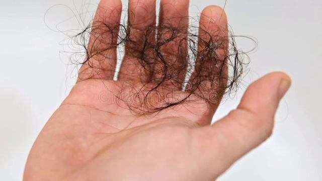 TOP 5 HOMEOPATHIC MEDICINES FOR HAIR FALL|| ALOPECIA TREATMENT||HOMEOPATHIC TREATMENT|| IN ENGLISH смотреть онлайн