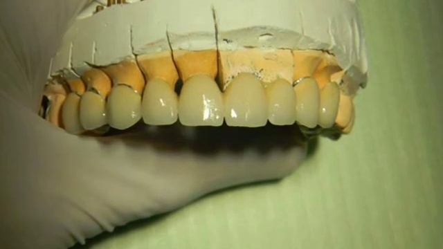 Металлокерамика г. Сумы №1 смотреть онлайн