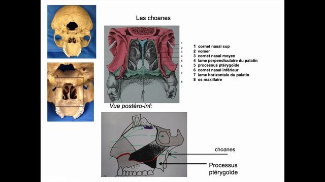 Cavités nasales : limites osseuses et pyramide nasale, sinus aériques смотреть онлайн