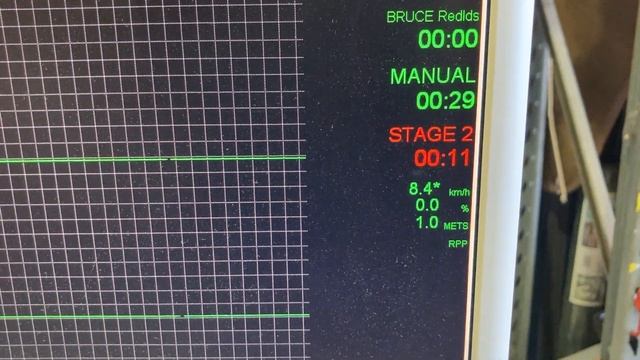 GE Medical T2100 Treadmill Exercise Stress Test System w CAM module ECG смотреть онлайн
