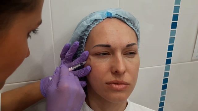 АирисКом: студенты учатся. Первая практика по теме ПРИМЕНЕНИЕ БОТОКСА смотреть онлайн