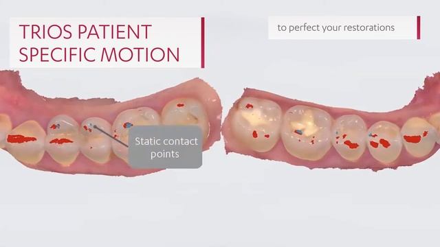 Noul 3Shape TRIOS 4 INTRAORAL SCANER смотреть онлайн