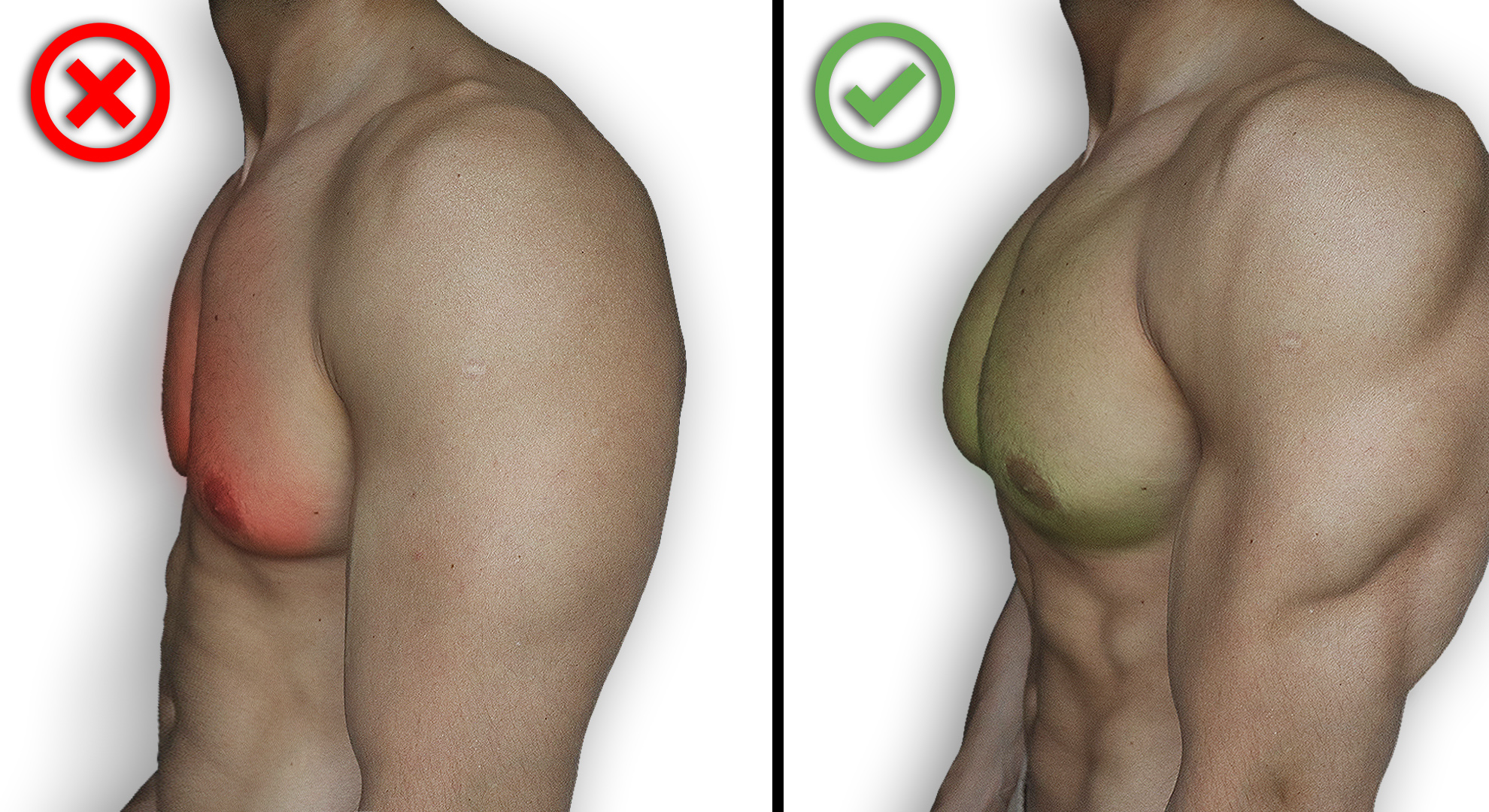 Рабочая методика увеличения грудной клетки смотреть онлайн