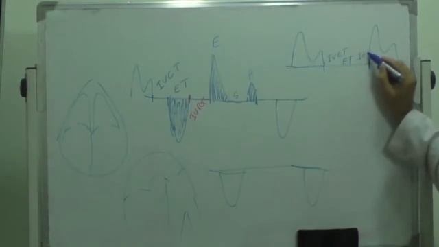 Sahak Echocardiography lecture 33 Diastolic Function (Mitral inflow velocity) смотреть онлайн