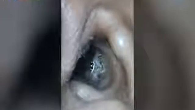 Spider living in human ear | Most painfull | Be careful смотреть онлайн